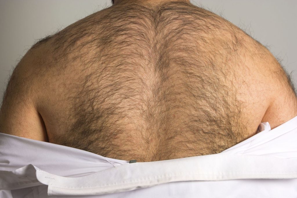 how to get rid of back hair permanently at home